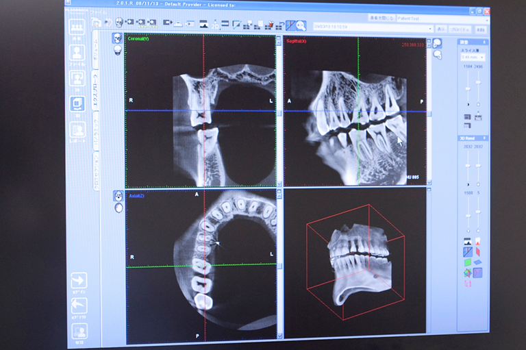 歯科用CT